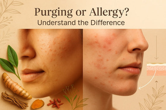 Split image showing skin purging on one side and allergic redness on the other, with herbal elements and warm beige tones, titled ‘Purging or Allergy?’