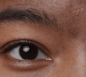 Dullness / Lack of Glow