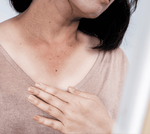 Tanning & Sun Damage