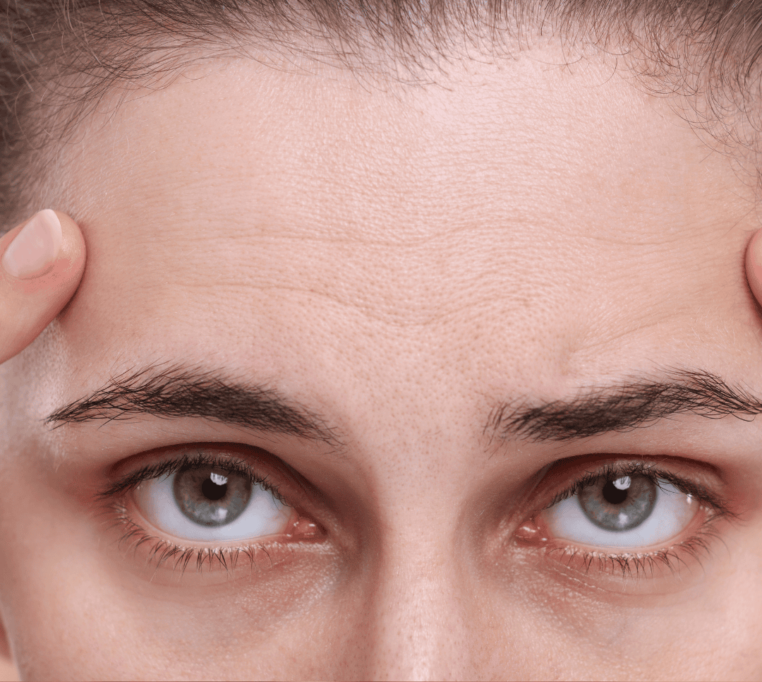 Fine Lines & Wrinkles (Anti-Aging)
